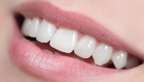 Lächeln mit gesunden und weißen Zähnen