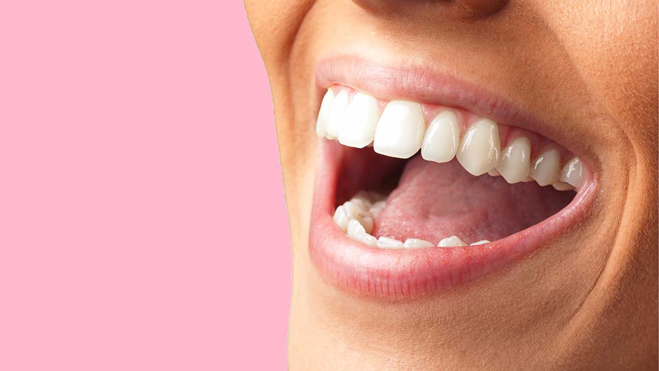Lachende Frau mit strahlend weißen Zähnen