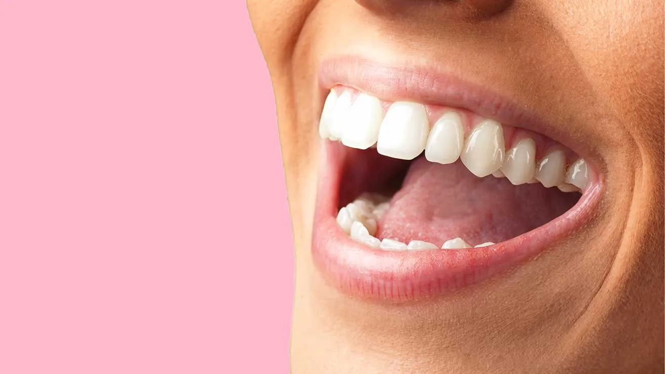 Zähne selber bleichen. Weißere Zähne durch Whitening Produkte.