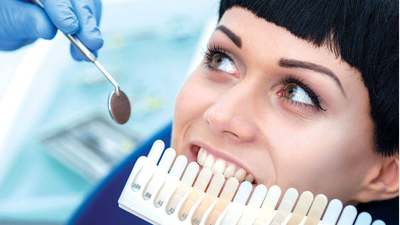 Professionelles Bleaching beim Zahnarzt